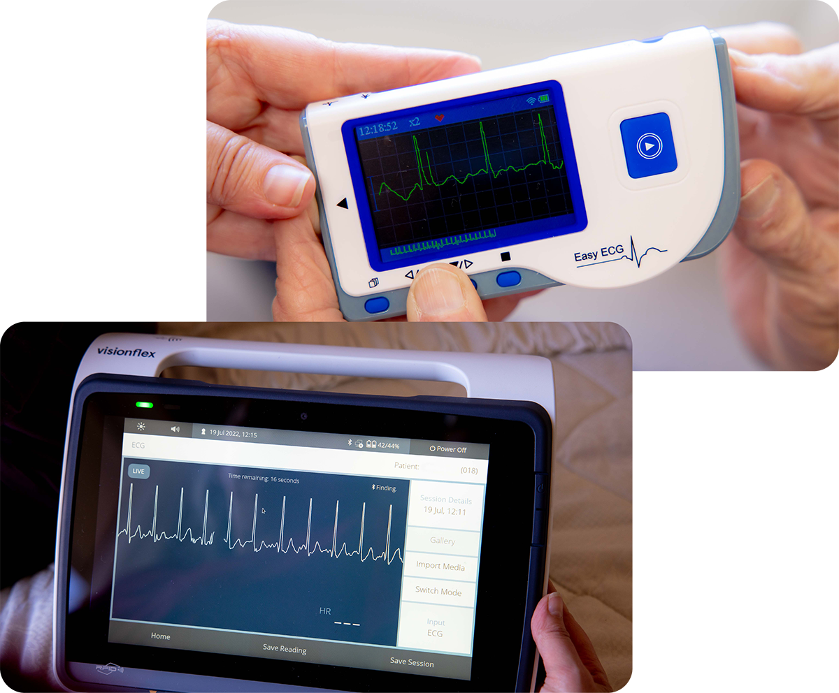 Pair of images showing a handheld ECG monitor in use with an image of the results on a ProEX Mobile device Pair of images showing a handheld ECG monitor in use with an image of the results on a ProEX Mobile device